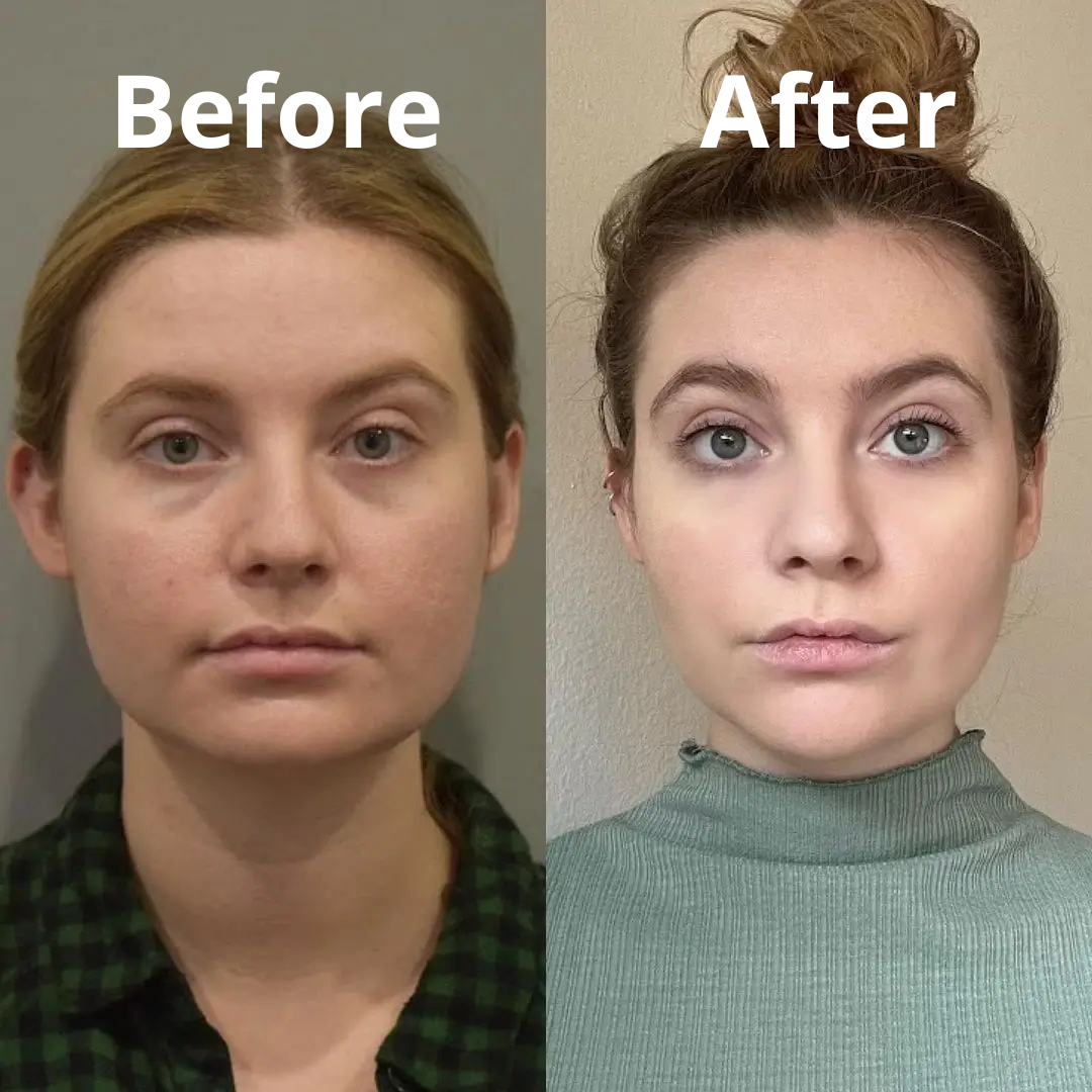 Lymphatic Drainage Supplement | Herbal Blend